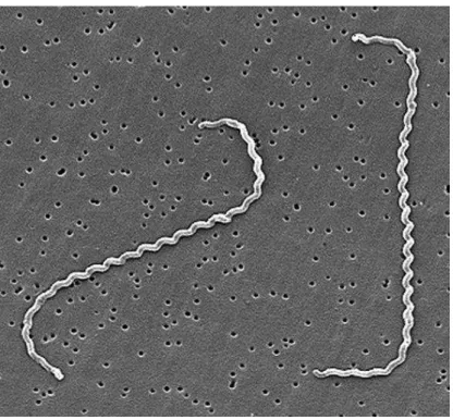 Figura  3  -  Fotomicrografia  eletrônica  de  varredura  de  L.  interrogans  sorovar  icterohaemorrhagie estirpe RGA 