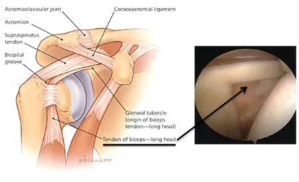 Figura  3.1.  Anatomia  do  ombro  e  localização  da  longa  porção  do  bicípete  [20]  numa  artroscopia da LPB num indivíduo sem patologia