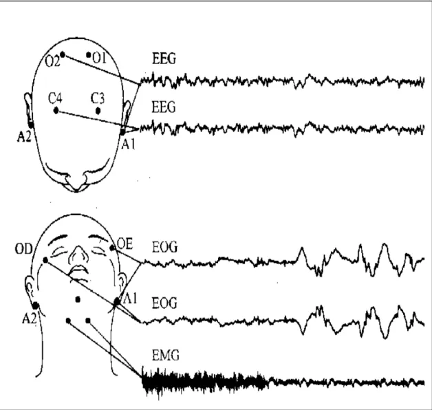 Figura 5 - Ilustração da colocação de eletrodos de EOG, EMG e EEG   (modificado de Rechtschaffen e Kales) 96 