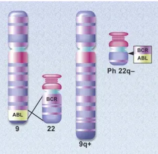 Figura 1 - Esquema da translocação que dá origem ao cromossomo Philadelphia. O gene ABL presente no  cromossomo 9 e o BCR no cromossomo 22 sofrem uma translocação formando um neogene, o  BCR-ABL