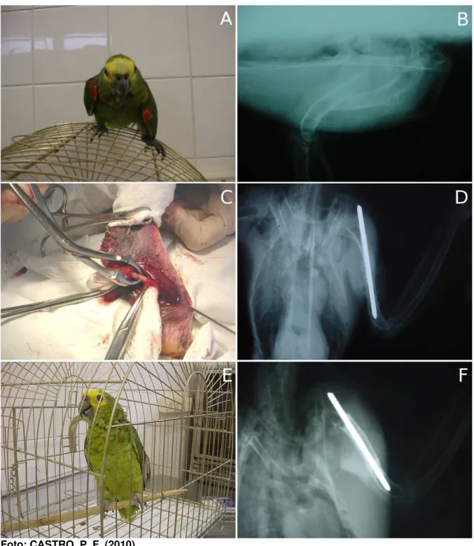 Figura 2 – Fratura fechada simples de úmero esquerdo em papagaio (Amazona  sp.). (A) Paciente  com asa esquerda caída