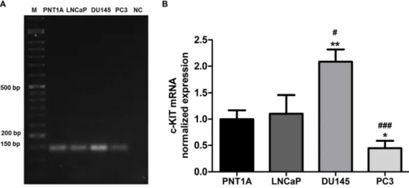 Figure  IV-1.  c-KIT  mRNA  expression  in  non-neoplastic  (PNT1A)  and  neoplastic  (LNCap,  DU145  and  PC3) human prostate cell lines