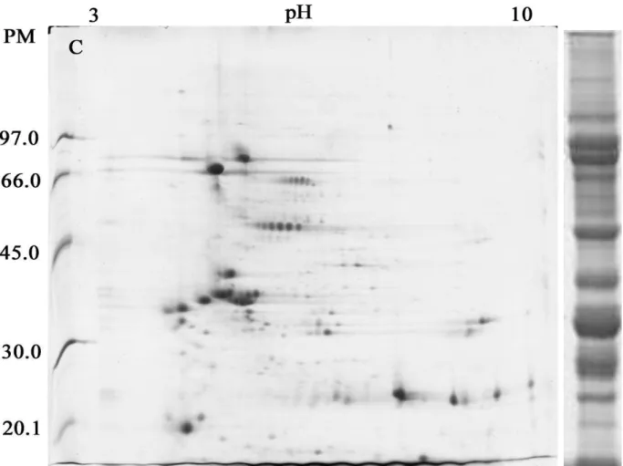 Figura 7 - Separação protéica de uma amostra de soja parental. No lado esquerdo  observamos  a  separação  por  eletroforese  bidimensional,  focalização  isoelétrica  realizada  em  gradiente  de  pH  linear  de  3-10