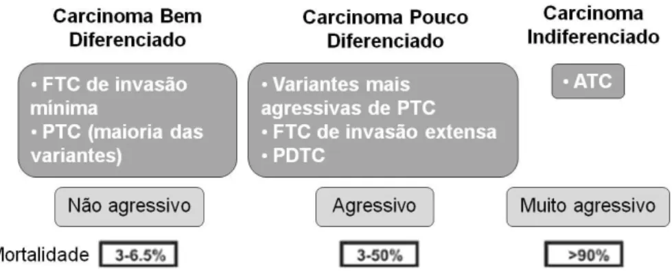 Figura 4 – Classificação dos carcinomas da tiróide derivados das células foliculares (adaptado de Clark &amp; 