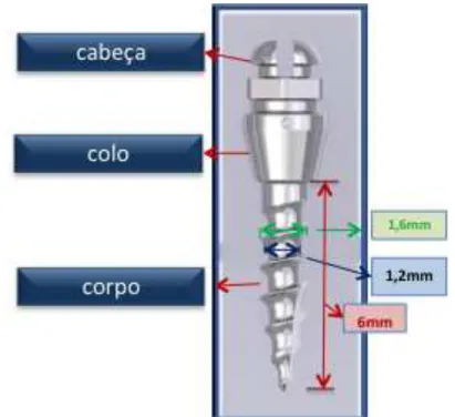 Figura  4.1  -  Mini-implante  autoperfurante  (TOMAS®  -  Temporary  Orthodontic  Micro  Anchorage  System, Dentaurum, Inspringen, Alemanha), utilizado no estudo 