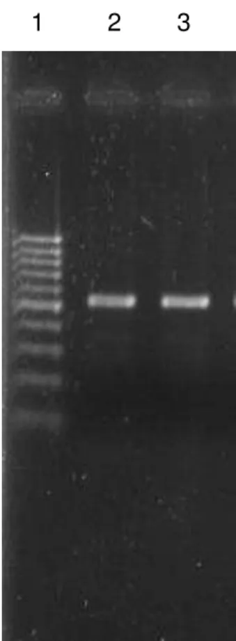 Figura 3-   Resultado da PCR direcionada ao lócus ITS-1 para detecção de N.  