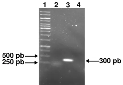 Figura  6  -  Detecção  de  RNAm  correspondentes  às  seqüências  clonadas  E7  e  gDE7  por  RT-PCR