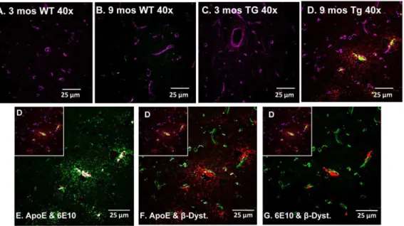 Figure 7. Increases in APOE levels are specific to 9 mos Tg-SwDI mice. Tissue sections representative of independent 3 and 9 month-old WT (A&amp;B) and 3 and 9 month-old Tg-SwDI (C&amp;D) animals were triple-labelled with APOE (red), 6E10 (green) and b-dys