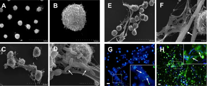 Figure 2. Scanning electron microscopy (SEM) and fluorescence micrographs of microbes trapped by METs-LS