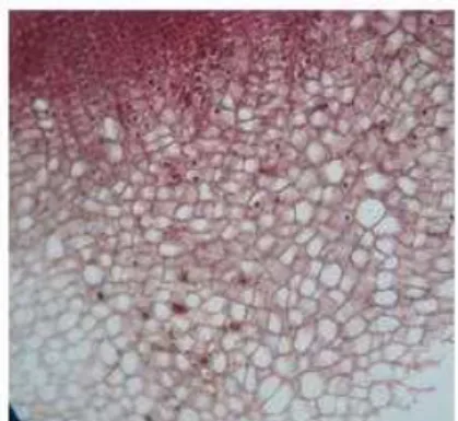 Fig 3: T.S. of Rubus ellipticus  bark passing    Fig 4:  T.S. of Rubus ellipticus  bark passing 