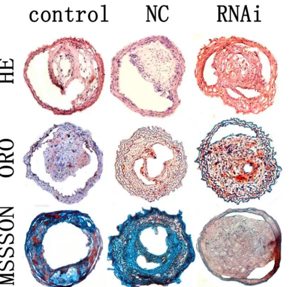 Fig 5. Carotid plaques in the control, NC and MEF 2A RNAi groups. Cross-sections of plaques in the control, NC and RNAi groups were stained with HE, ORO and masson’s trichrome