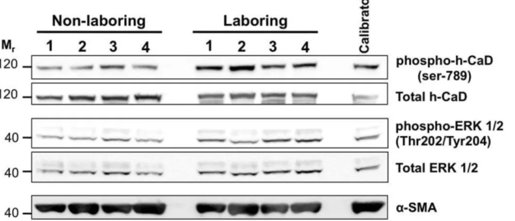 Figure 2C). Although total ERK2 expression increased by 38% during the onset of labor, densitometric analysis revealed no change in the ratio of phospho-ERK2/total ERK2 between NIL and L laboring human myometrium (P = 0.475; Figure 2D).