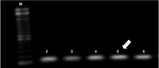 Tabela 3 – Condições de  amplificação pela PCR para os polimorfismos dos genes LIGHT, LTA,  MMP9, E-SELECTINA, NFKB, LGALS2, VCAM1 e ICAM1