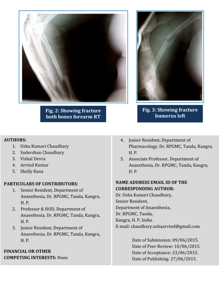 Fig. 2: Showing fracture   both bones forearm RT 