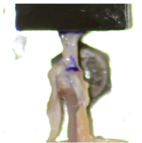 Figura 3 - Detalhe do posicionamento do tendão supraespinal durante a realização de teste  biomecânico  