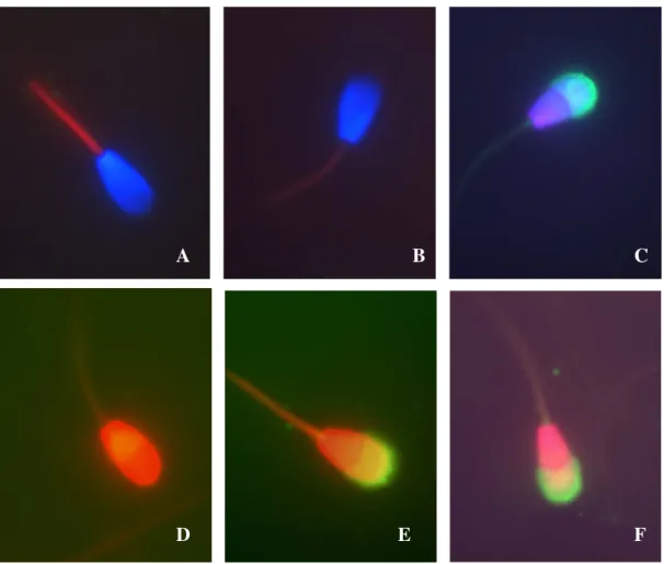 Figura 9 - Fotomicrografia  de  epifluorescência  das  células  espermáticas  coradas  com  a  associação  das  sondas  fluorescentes  PI,  H342,  FITC-PSA  e  CMXRos  (aumento  1.000 x)