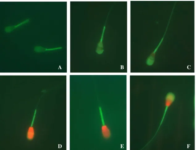 Figura 5 - Fotomicrografia  de  epifluorescência  das  células  espermáticas  coradas  com  a  associação das sondas fluorescentes PI, FITC-PSA e MITO (aumento 1.000 x)