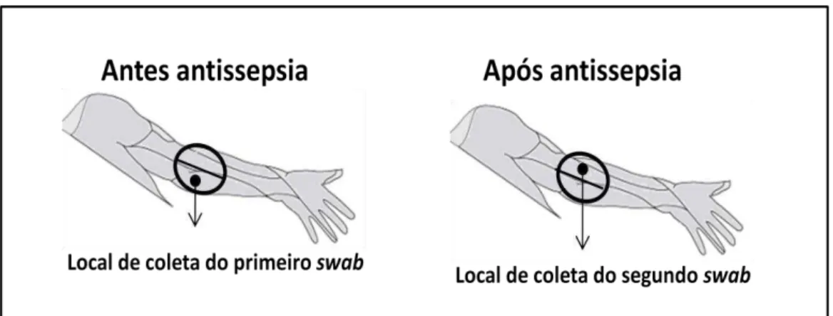 Figura  2  –   Representação  esquemática  do  local  de  coleta  do  swab  do  braço  do  doador antes e após a antissepsia