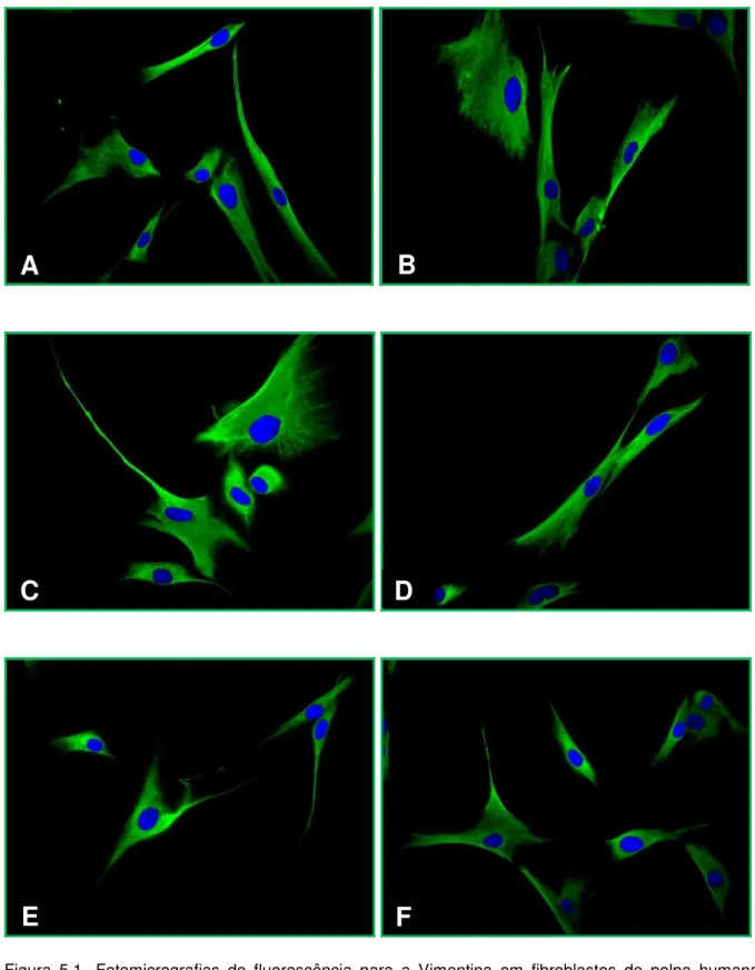 Figura  5.1-  Fotomicrografias  de  fluorescência  para  a  Vimentina  em  fibroblastos  de  polpa  humana  (FP5): grupo controle (A), após exposição aos fármacos pasta Guedes-Pinto (B), Vitapex ®  (C), pasta OZE (D), Calen ®  (E) e Calen PMCC ®  (F)