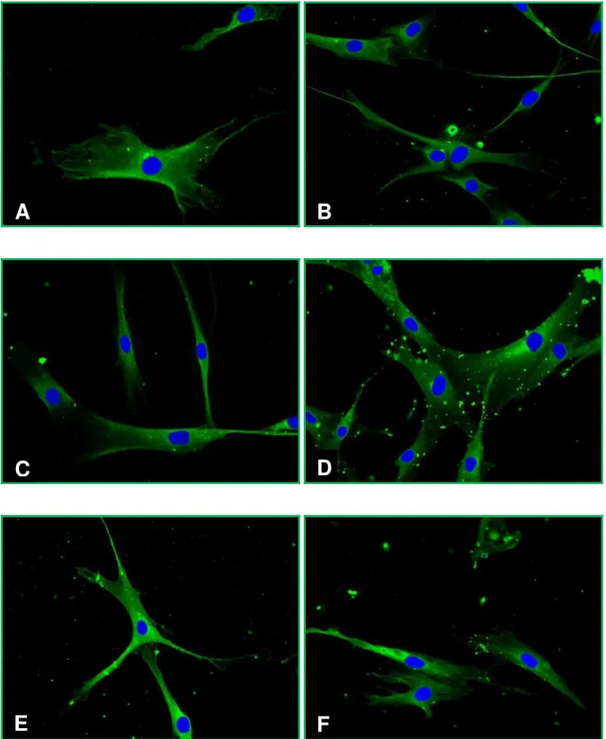 Figura  5.3-  Fotomicrografias  de  fluorescência  para  o  Colágeno  I  em  fibroblastos  de  polpa  humana  (FP5):  grupo  controle  (A),  após  exposição  aos  fármacos  pasta  Guedes-Pinto  (B),  Vitapex ®  (C), pasta OZE (D), Calen ®  (E) e Calen PMCC