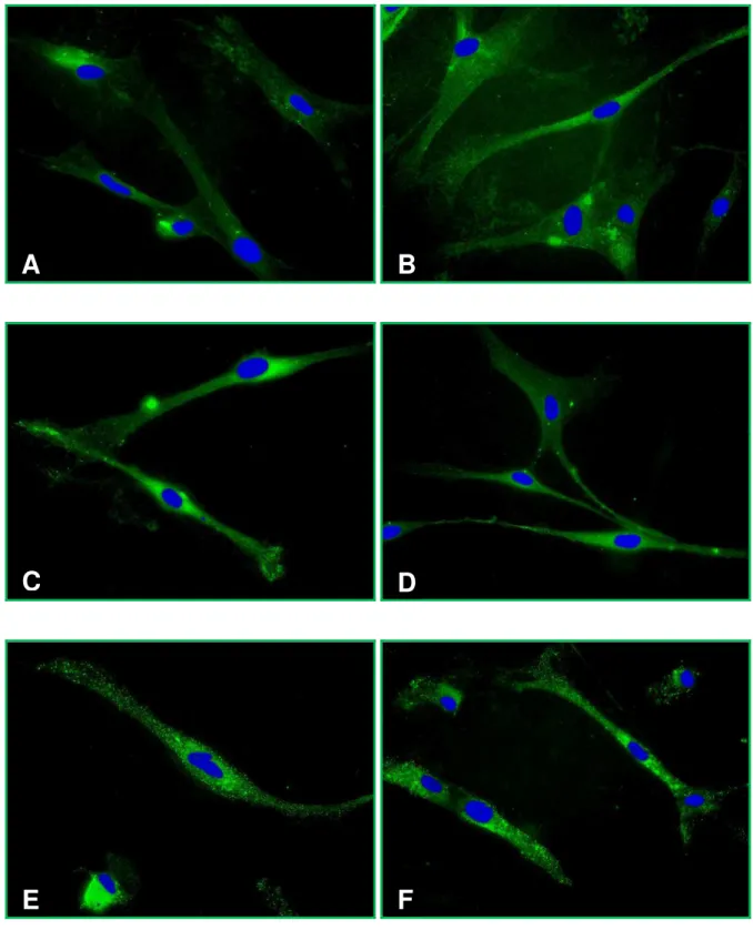 Figura  5.4-  Fotomicrografias  de  fluorescência  para  a  Tenascina  em  fibroblastos  de  polpa  humana  (FP5):  grupo  controle  (A),  após  exposição  aos  fármacos  pasta  Guedes-Pinto  (B),  Vitapex ®  (C), pasta OZE (D), Calen ®  (E) e Calen PMCC ®