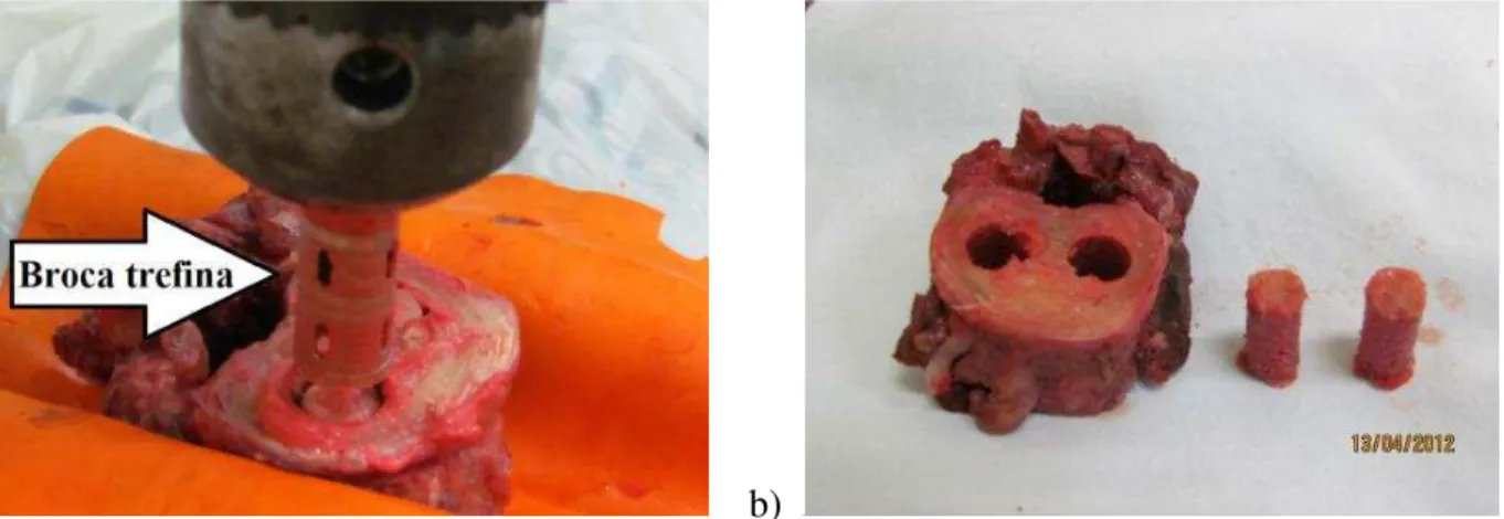Figura 4.5.1 - a) Perfuração do corpo vertebral através da broca trefina; b) amostras cilíndricas do osso trabecular