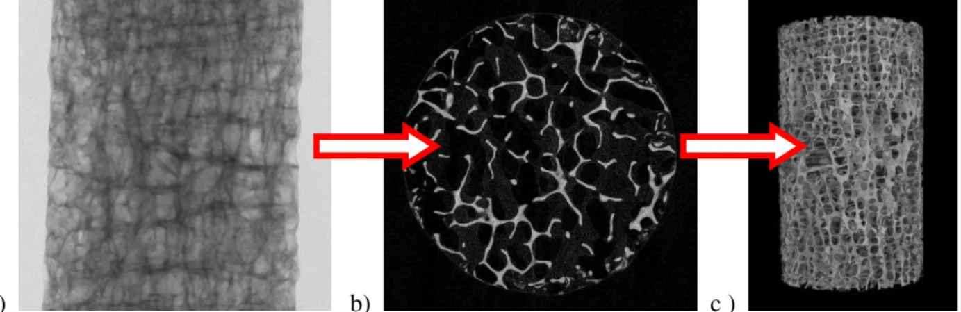 Figura 4.6.2 - Imagens microtomográficas: a) Escaneamento (seções transversais em função da altura) do corpo de  prova  de  ossos  trabeculares  de  vértebra  humana  (cadáver),  classificado  como  normal;  b)  Fatia  binarizada  reconstruída (modelo 2D);