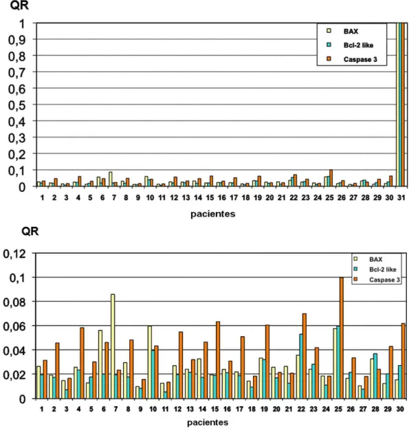 Figura  12.  Comparação  entre  a  expressão  gênica,  representada  pela  quantificação  relativa  (QR)  obtidos  para  Bax,  Bcl-2  e  caspase  3  nos  pacientes  em  comparação  à  hipófise normal (gráfico superior) ou apenas entre os pacientes (gráfico