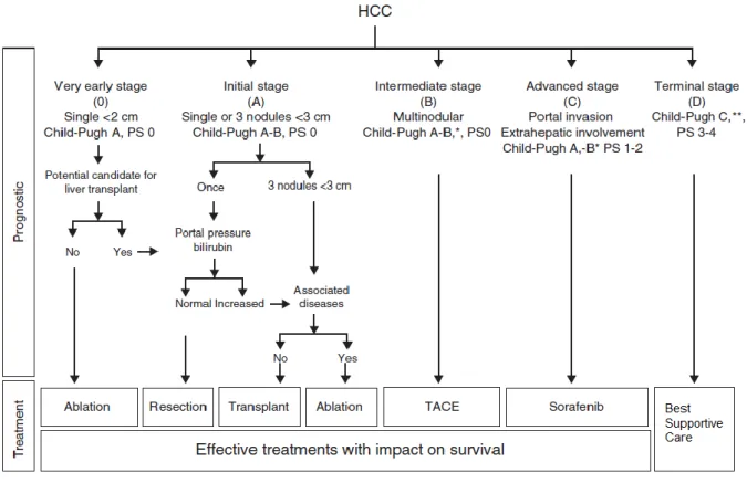 Figura 1.5 Sistema de estadiamento BCLC para o CHC. * A classificação Child-Pugh não identifica todos os pacientes  com disfunção hepática grave que podem ser considerados para transplante hepático