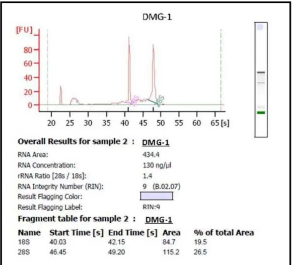 Figura 4. Densintometria da amostra de RNA de paciente com DMG isolada de PBMCs. 