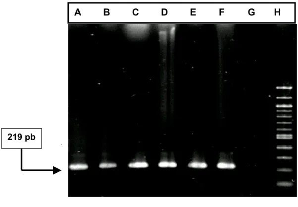 Figura 1 - Eletroforese dos produtos nested-PCR correspondentes ao  gene codificador da glicoproteína E do VLTI