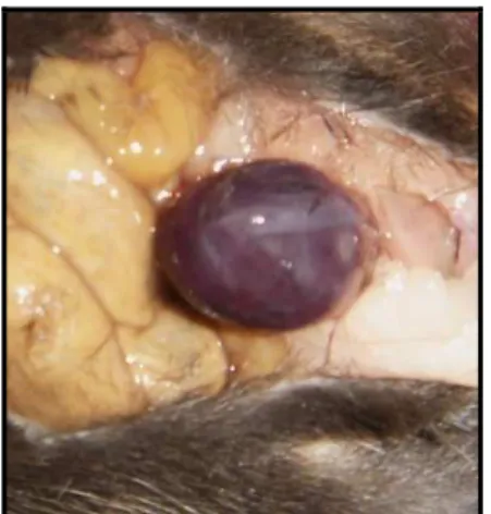 Figura 4 – Bexiga acometida por tumor  observado durante cistectomia. 
