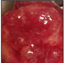 Figura 5 – Aspecto macroscópico do  carcinoma urotelial no camundongo,  após cistectomia