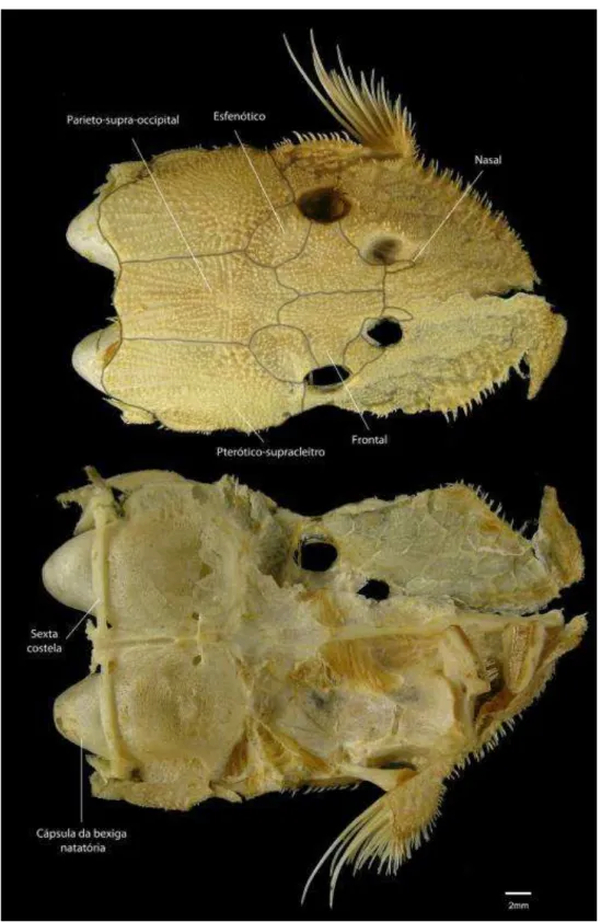 Figura 4. Vista dorsal e ventral do neurocrânio de Acanthicus hystrix (MZUSP 34244 -174,61  mm CP)