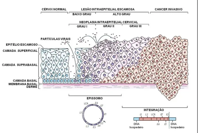 Figura 2. Ciclo de vida do Papilomavírus humano. Através da perda da integridade física do epitélio  cervical, as partículas virais infectam as células da camada basal
