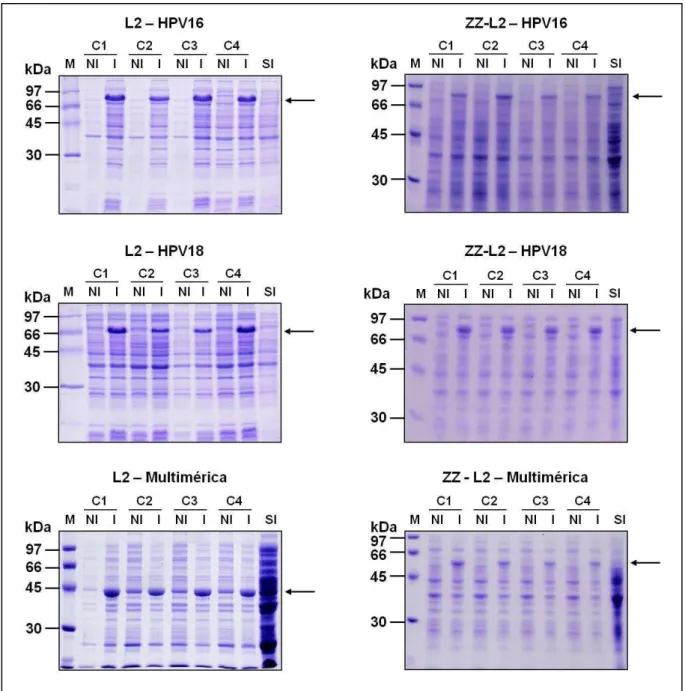Figura  16.  Gel  de  poliacrilamida  10  e  12%  da  análise  da  expressão  de  clones  da  bactéria  BL21SI  submetidas  à  indução  com  NaCl