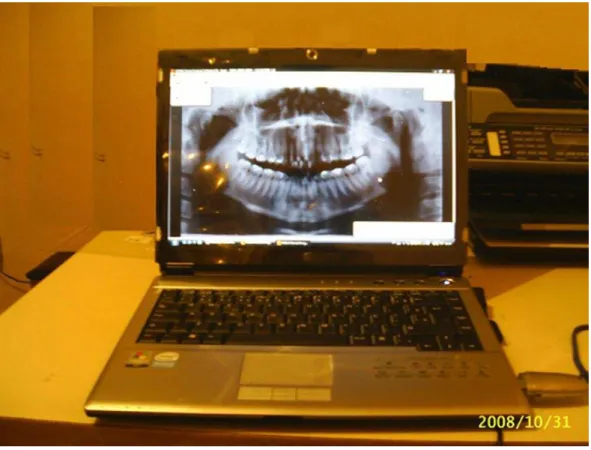 Figura 4.8 - Radiografia panorâmica final digitalizada 