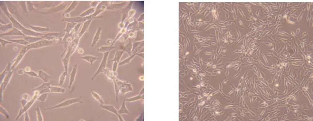 Figura 8 :  Fotografias das células da linha celular N27 (200x e 100x, respectivamente)