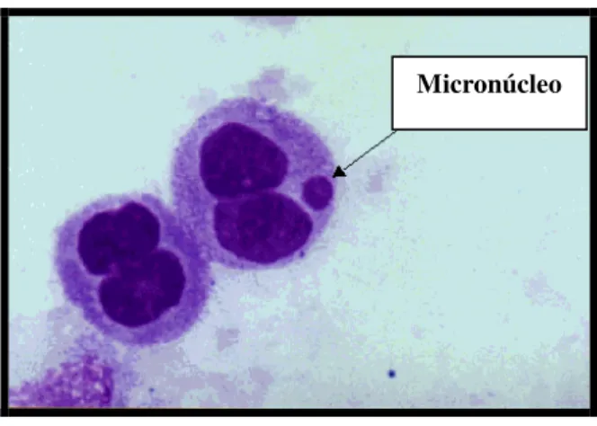 FIGURA  2:  Micronúcleo  em  célula  binucleada,  proveniente  de  ação  aneugênica. 