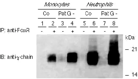 Figura 8. Aumento da expressão da cadeia γγγγ associada ao Fcα α αRI nos α fagócitos dos pacientes com bacteremia por gram-negativos.