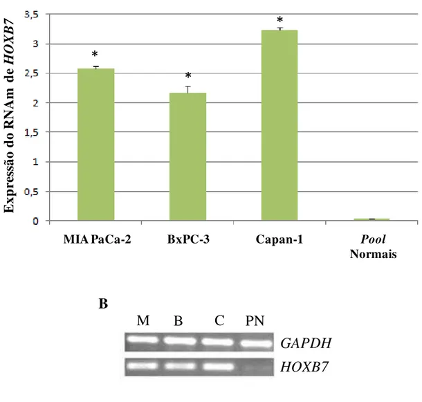 Figura  3.  Expressão  do  RNAm  do  gene  HOXB7  nas  linhagens  celulares  derivadas  de  adenocarcinoma pancreático ductal e no pool  de tecidos pancreáticos normais