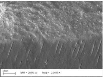 Figure 5. SEM micrograph of superficial dentin subsurface irradiated with 160 mJ 