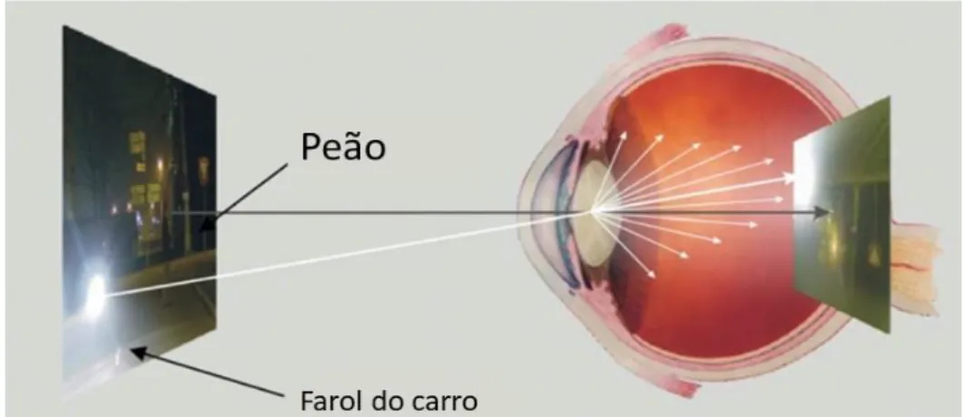 Figura  5    À  direita  está  representado  a  imagem  retiniana  da  imagem  da  esquerda  de  um  paciente com elevados valores de EIO
