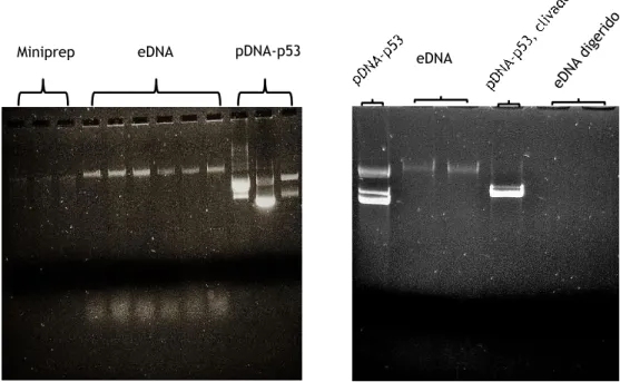 Figura 13: Gel de eletroforese 0,8% de agarose, mostrando possíveis bandas de pDNA extraídas de R