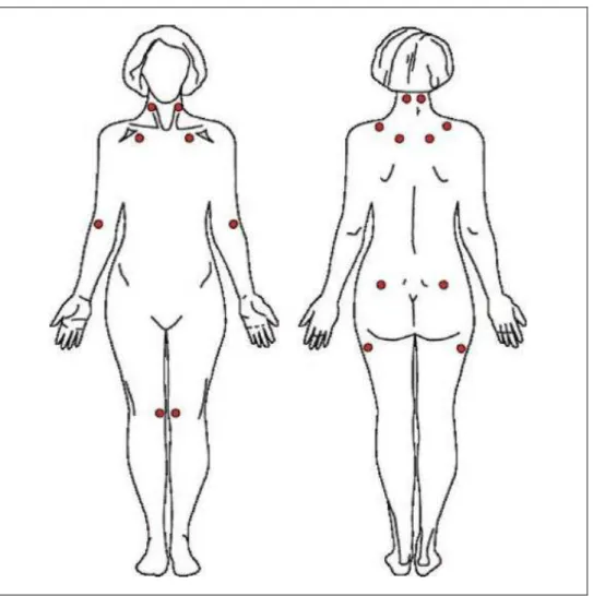 Figura 1  –  Representação dos 18 pontos dolorosos  Fonte: Wolfe et al, 1990 