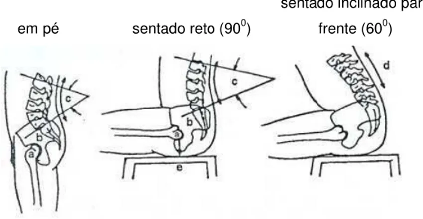 Figura 2.23 - Mudanças que ocorrem na coluna e nos ossos da bacia com a passagem da postura em  pé para a sentada 