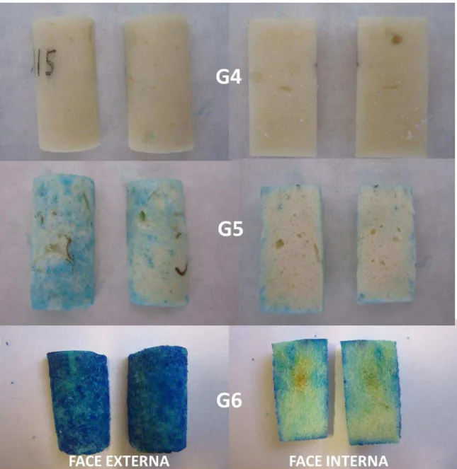 Figura 10. Análise visual de preenchimento com azul de metileno dos grupos  G4 (PMMA compacto), G5 (cimento mamona), G6 (osso bovino)
