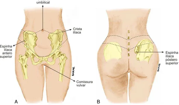 Figura 1. Parâmetros anatômicos na demarcação da abdominoplastia circunferencial  A. Vista anterior, B