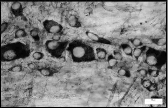 Figura 10 - Fotomicrografia de preparado de membrana do estômago de rato  do  grupo diabético suplementado evidenciando gânglio com neurônios  mioentéricos nadh-d reativos com perfil do corpo celular de tamanhos  variados