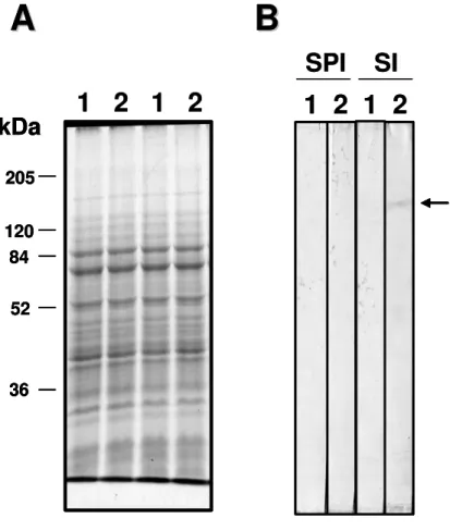 Figura 13. Análise da expressão da PRP1 em formas promastigotas de L. major. (A) SDS-PAGE a  8% contendo as proteínas de membrana de promastigotas de L